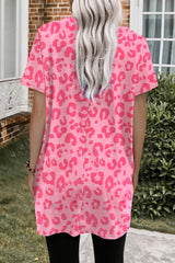 Pink Leopard Print Short Sleeve Tunic Top Tops & Tees JT's Designer Fashion